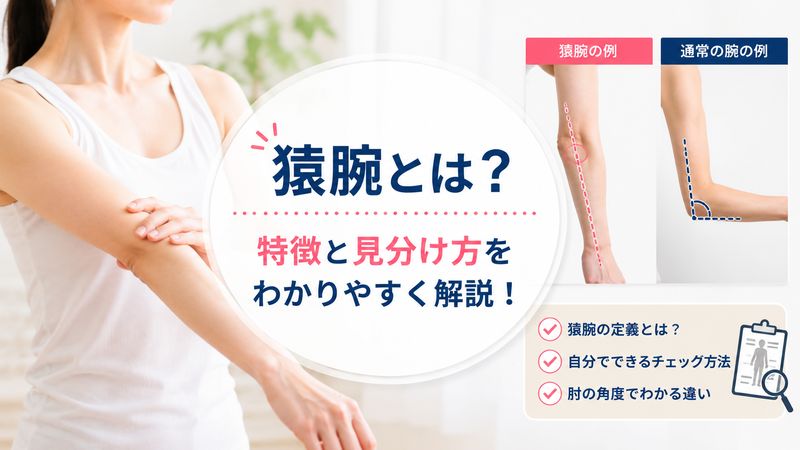 1.猿腕とは何か?その特徴と見分け方